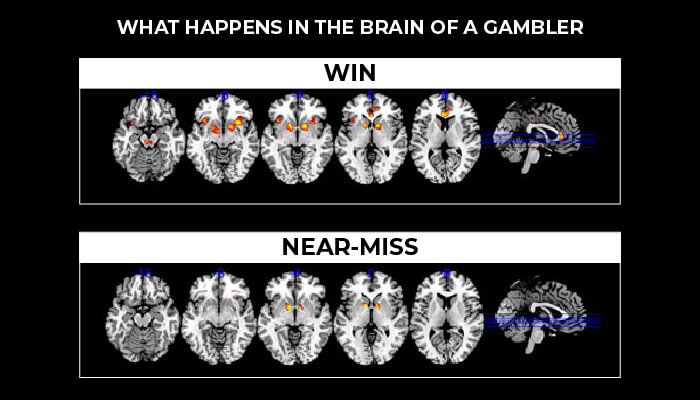 What happens in the brain of a gambler